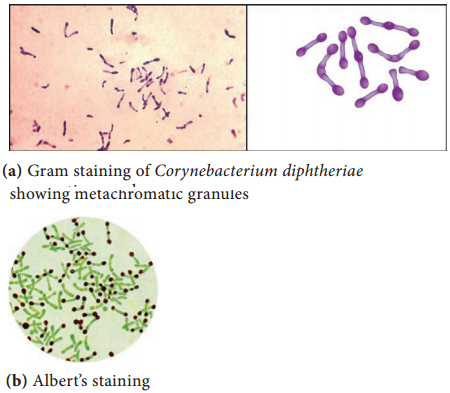 Corynebacterium Chinese Letters